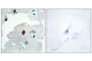Immunohistochemistry (IHC) image for anti-Pituitary Tumor-Transforming 1 (PTTG1) (Internal Region) antibody (ABIN1849461) (PTTG1 antibody  (Internal Region))