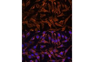 Immunofluorescence analysis of L929 cells using TNFRSF11A Polyclonal Antibody (ABIN6127588, ABIN6149309, ABIN6149311 and ABIN6216817) at dilution of 1:100 (40x lens). (TNFRSF11A antibody  (AA 466-616))