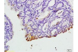 Formalin-fixed and paraffin embedded rat colitis tissue labeled with Anti-CXCR1/IL-8RA Polyclonal Antibody, Unconjugated  at 1:200, followed by conjugation to the secondary antibody and DAB staining (CXCR1 antibody  (AA 186-280))