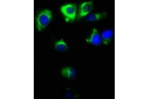 Immunofluorescence staining of MCF-7 cells with ABIN7171138 at 1:100, counter-stained with DAPI.