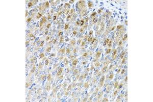 Immunohistochemistry of paraffin-embedded mouse stomach using MTX2 antibody at dilution of 1:100 (x40 lens). (MTX2 antibody)