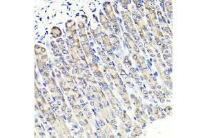 Immunohistochemistry of paraffin-embedded mouse stomach using MAPKBP1 antibody (ABIN5971432) at dilution of 1/100 (40x lens). (MAPKBP1 antibody)