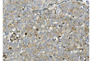 IHC analysis of ASAH1 using anti-ASAH1 antibody (ABIN7602206). (ASAH1 antibody  (AA 63-393))