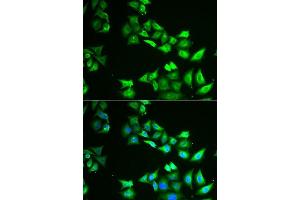 Immunofluorescence analysis of U2OS cells using CCBL1 antibody. (CCBL1 antibody  (AA 1-270))