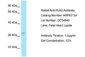 Western Blotting (WB) image for anti-Plasminogen Activator, Urokinase (PLAU) (C-Term) antibody (ABIN2789605) (PLAU antibody  (C-Term))