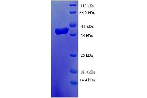 SDS-PAGE (SDS) image for Transcription Elongation Factor B (SIII), Polypeptide 1 (15kDa, Elongin C) (TCEB1) (AA 1-112), (full length) protein (GST tag) (ABIN5710466)