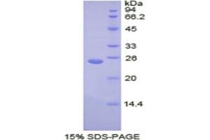 SDS-PAGE analysis of Human Transportin 1 Protein.