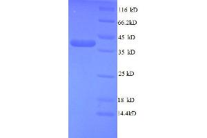 SDS-PAGE (SDS) image for Teratocarcinoma-Derived Growth Factor 1 (TDGF1) (AA 32-150), (partial) protein (GST tag) (ABIN1047738)