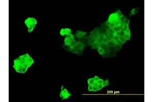 Immunofluorescence of monoclonal antibody to MYH9 on A-431 cell. (Myosin 9 antibody  (AA 131-220))