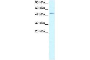 CCR8 antibody (20R-1321) used at 5 ug/ml to detect target protein. (CCR8 antibody  (Middle Region))