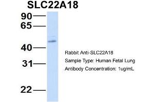Host:  Rabbit  Target Name:  SLC22A18  Sample Type:  Human Fetal Lung  Antibody Dilution:  1. (ORCTL-2/SLC22A18 antibody  (N-Term))