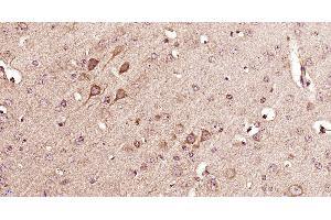 Paraformaldehyde-fixed, paraffin embedded mouse brain, Antigen retrieval by boiling in sodium citrate buffer (pH6) for 15min, Block endogenous peroxidase by 3% hydrogen peroxide for 30 minutes, Blocking buffer (normal goat serum) at 37°C for 20min, Antibody incubation with 14-3-3 beta Polyclonal Antibody, Unconjugated  at 1:400 overnight at 4°C, followed by a conjugated secondary and DAB staining. (YWHAB antibody  (AA 51-150))