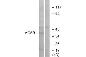 Western blot analysis of extracts from K562 cells, using MC5R antibody.