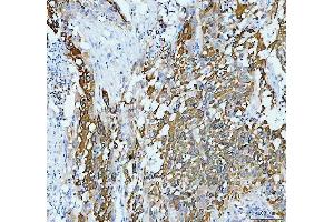 IHC analysis of AGR2 using anti-AGR2 antibody (ABIN5518726). (AGR2 antibody  (AA 21-175))