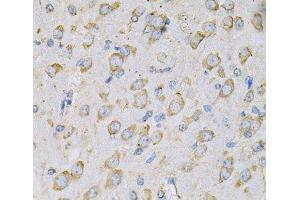 Immunohistochemistry of paraffin-embedded Rat brain using IL10RA Polyclonal Antibody at dilution of 1:100 (40x lens). (IL-10RA antibody)