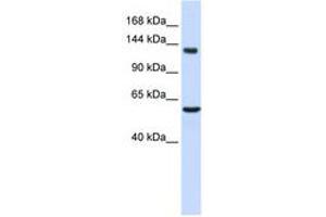 Image no. 1 for anti-Inhibin Binding Protein (INHBP) (C-Term) antibody (ABIN6743082) (IGSF1 antibody  (C-Term))