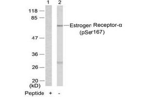 Image no. 3 for anti-Estrogen Receptor 1 (ESR1) (pSer167) antibody (ABIN196744) (Estrogen Receptor alpha antibody  (pSer167))