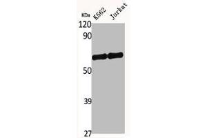 Western Blot analysis of K562 Jurkat cells using SNM1B Polyclonal Antibody (DCLRE1B antibody  (C-Term))