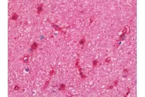 Anti-SNTA1 / Syntrophin Alpha 1 antibody IHC staining of human brain, cortex. (SNTA1 antibody  (AA 191-505))