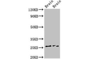 Western Blot Positive WB detected in: Rat brain tissue, Mouse brain tissue All lanes: FAM3B antibody at 3 μg/mL Secondary Goat polyclonal to rabbit IgG at 1/50000 dilution Predicted band size: 26, 31, 21 kDa Observed band size: 26 kDa (FAM3B antibody  (AA 31-235))