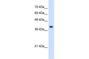 Western Blotting (WB) image for anti-Interferon-Induced Protein 44-Like (IFI44L) antibody (ABIN2462952)