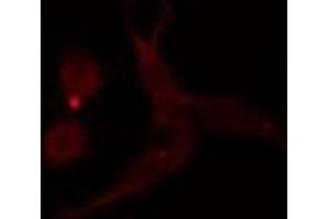ABIN6276825 staining  A549 cells by IF/ICC. (MAD2L1 antibody  (Internal Region))