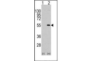 Image no. 2 for anti-Myocyte Enhancer Factor 2C (MEF2C) (Ser387) antibody (ABIN358801) (MEF2C antibody  (Ser387))