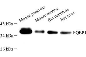 Western blot analysis of PQBP1 (ABIN7075126) at dilution of 1: 1000