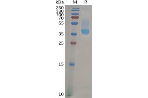 CXCR4 Protein (Fc Tag)