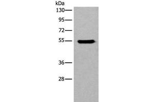 Western blot analysis of HEPG2 cell lysate using CYP11B2 Polyclonal Antibody at dilution of 1:650