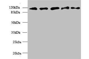 Western blot All lanes: MORC2 antibody at 6 μg/mL Lane 1: U87 whole cell lysate Lane 2: U251 whole cell lysate Lane 3: Jurkat whole cell lysate Lane 4: Hela whole cell lysate Lane 5: MCF-7 whole cell lysate Secondary Goat polyclonal to rabbit IgG at 1/10000 dilution Predicted band size: 118, 111 kDa Observed band size: 118 kDa (MORC2 antibody  (AA 2-300))