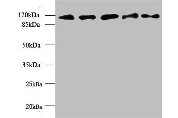 MORC2 anticorps  (AA 2-300)