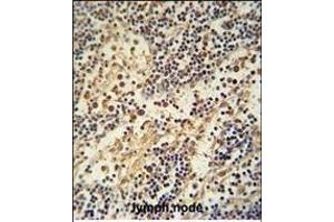 HEMK1 antibody (C-term) (ABIN654963 and ABIN2844602) immunohistochemistry analysis in formalin fixed and paraffin embedded human lymph node followed by peroxidase conjugation of the secondary antibody and DAB staining. (HEMK1 antibody  (C-Term))