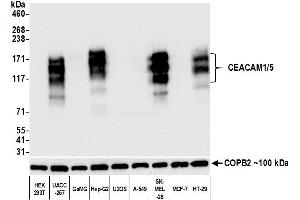 Western Blotting (WB) image for anti-Carcinoembryonic Antigen-Related Cell Adhesion Molecule 1/5 (CEACAM1/5) (AA 35-433) antibody (ABIN7455139) (Recombinant CEACAM1/5 antibody  (AA 35-433))