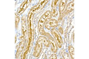 Immunohistochemistry of paraffin-embedded rat kidney using DENN Rabbit mAb (ABIN7268396) at dilution of 1:50 (40x lens). (MADD antibody)