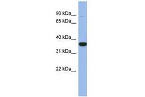 Image no. 1 for anti-Fanconi Anemia, Complementation Group L (FANCL) (AA 143-192) antibody (ABIN6744042) (FANCL antibody  (AA 143-192))