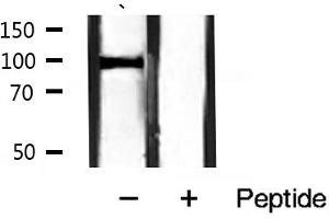 Western blot analysis of Catenin α1 expression in mouse muscle tissue lysates,The lane on the right is treated with the antigen-specific peptide. (CTNNA1 antibody  (C-Term))