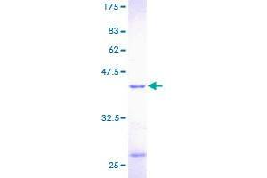 Image no. 1 for Profilin 1 (PFN1) (AA 1-140) protein (GST tag) (ABIN1314757) (PFN1 Protein (AA 1-140) (GST tag))