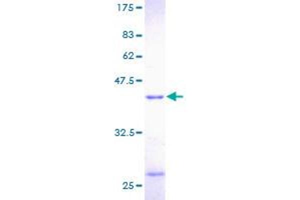 PFN1 Protein (AA 1-140) (GST tag)