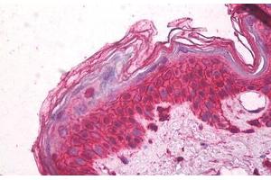 Image no. 1 for anti-Chemokine (C-C Motif) Receptor 3 (CCR3) (AA 5-28) antibody (ABIN1495440) (CCR3 antibody  (AA 5-28))