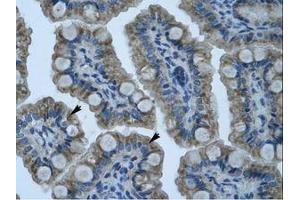 Image no. 1 for anti-Zinc Finger Protein 461 (ZNF461) (AA 26-75) antibody (ABIN203139) (ZNF461 antibody  (AA 26-75))