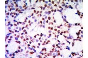 Immunohistochemical analysis of paraffin-embedded human kidney tissue using PP32 mouse mAb with DAB staining. (PHAP1 antibody)