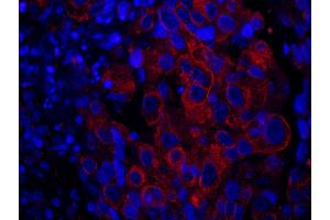 Immunofluorescence (IF) image for anti-SAM and SH3 Domain Containing 1 (SASH1) (AA 750-800) antibody (ABIN7449021) (SASH1 antibody  (AA 750-800))