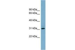Image no. 1 for anti-Ring Finger Protein 144B (RNF144B) (AA 215-264) antibody (ABIN6743180) (RNF144B antibody  (AA 215-264))