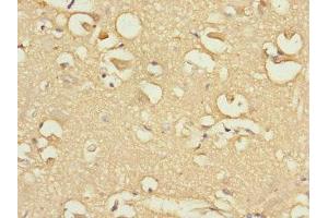 Immunohistochemistry of paraffin-embedded human brain tissue using ABIN7152437 at dilution of 1:100