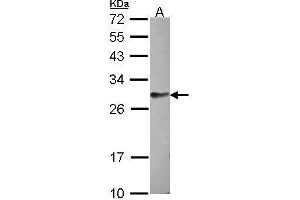 WB Image Sample (30 ug of whole cell lysate) A: HCT116 12% SDS PAGE antibody diluted at 1:1000