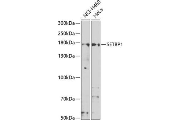 SETBP1 antibody  (AA 1-242)