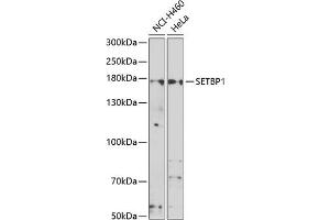 Western blot analysis of extracts of various cell lines, using SETBP1 antibody (ABIN6132919, ABIN6147635, ABIN6147636 and ABIN6223042) at 1:1000 dilution. (SETBP1 antibody  (AA 1-242))