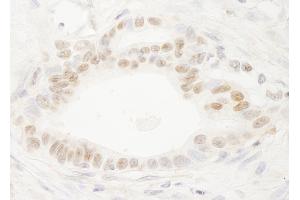 anti-DEK Oncogene (DEK) (AA 325-375) antibody