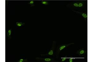 Immunofluorescence of monoclonal antibody to STK24 on HeLa cell. (STK24 antibody  (AA 1-431))